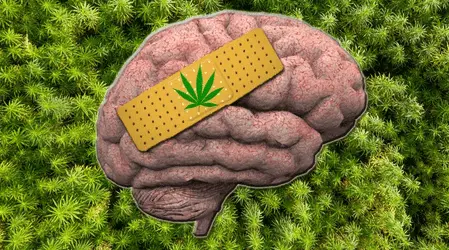 Каннабис помогает 9 из 10 пациентов с мигренью: исследование