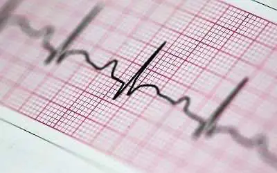 Как употребление конопли влияет на здоровье и ритм сердца