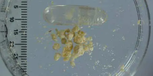 Заключительная фаза клинических испытаний МДМА показывает, что лекарство на 90% эффективно при лечении посттравматического стрессового расстройства